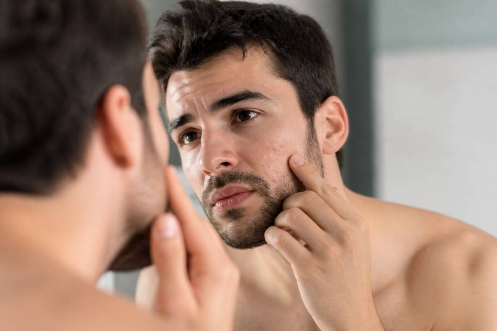 Cartographie bouton visage : causes, zones et solutions efficaces Cartographie bouton visage : causes, zones et solutions efficaces