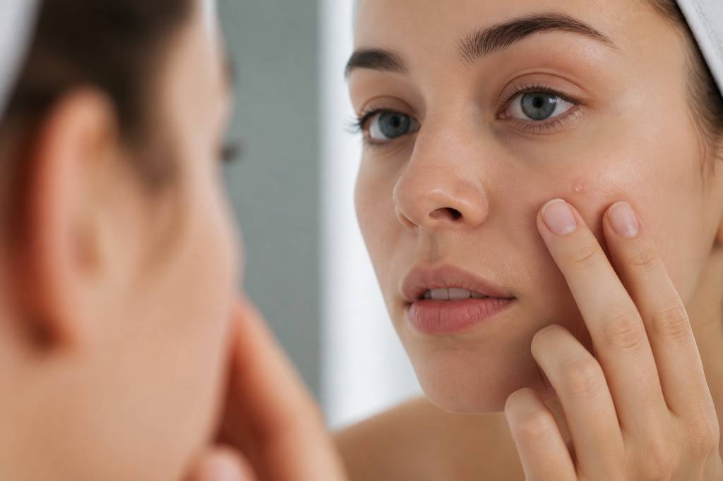 Boule blanche visage : causes, solutions et traitements efficaces Boule blanche visage : causes, solutions et traitements efficaces
