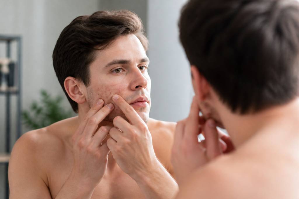 Face mapping bouton : causes, zones du visage et solutions Face mapping bouton : causes, zones du visage et solutions